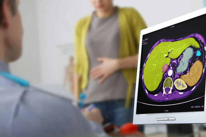 Una mujer con la mano en el abdomen y un médico que observa una tomografía abdominal.